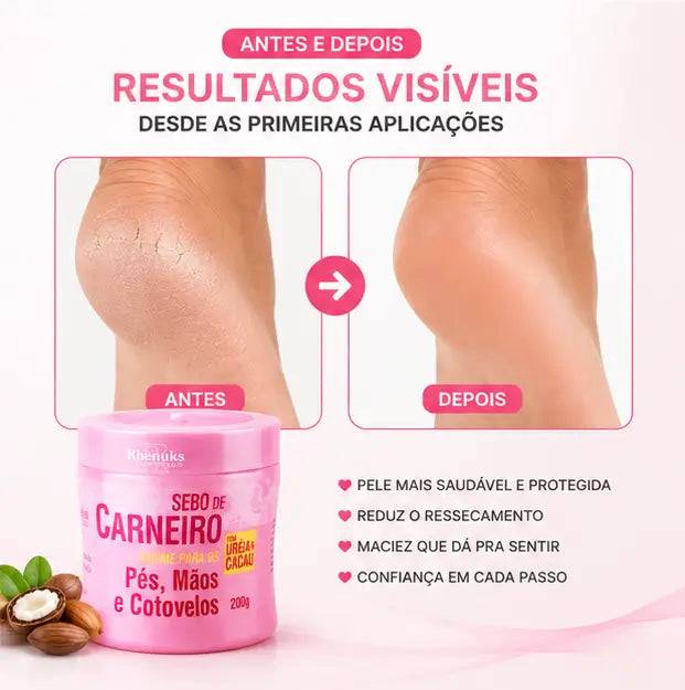 Creme Hidratante Anti Rachaduras | Pé de Seda™ – Acabe com o ressecamento e as rachaduras dos pés