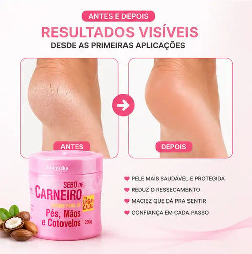 Creme Hidratante Anti Rachaduras | Pé de Seda™ – Acabe com o ressecamento e as rachaduras dos pés