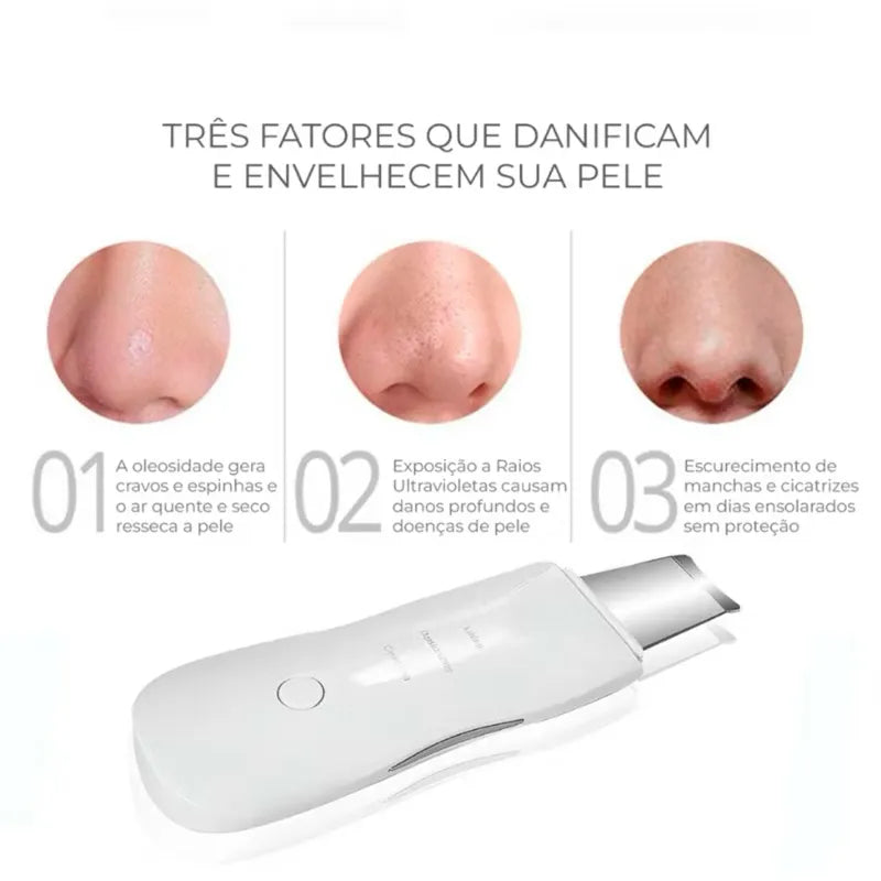 Aparelho de Peeling Facial - DermaPeel Pro - Moda e Beleza - Eleganza Style