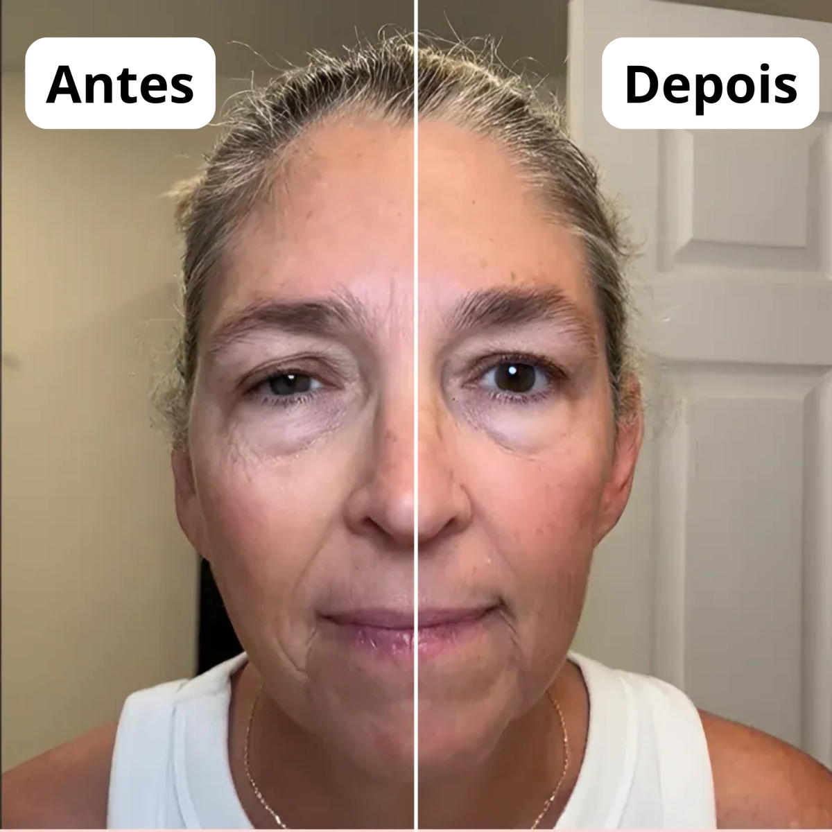 Fluxia® - Escova de Drenagem Linfática Facial - Eleganza Style