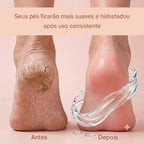 Meias Hidratantes de Silicone | SoftFeet™ - Pés mais macios, hidratados e livres do ressecamento