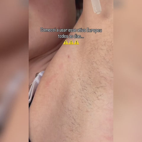 Sérum Redutor de Pelos | Bye Bye Pelos Lisinha® - Reduza 91% do crescimento em 30 dias